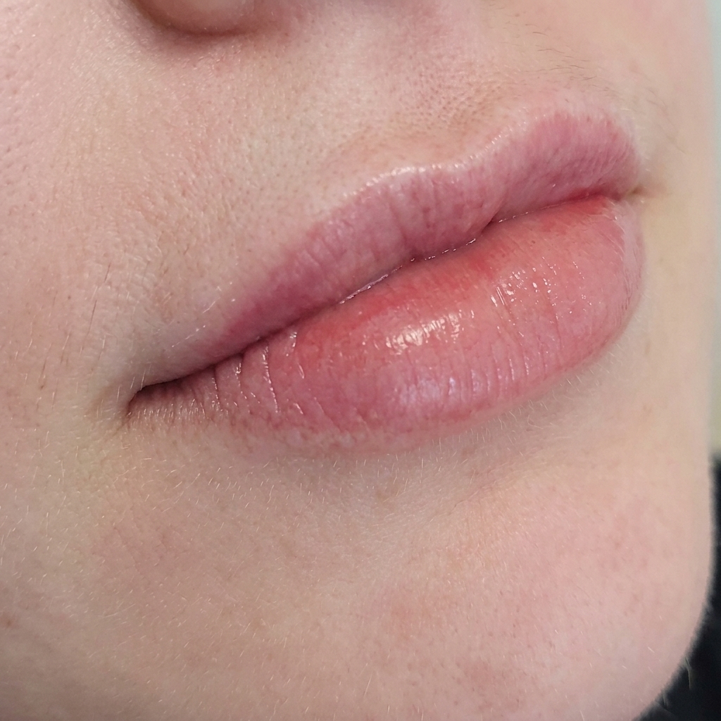 Thin Lips After