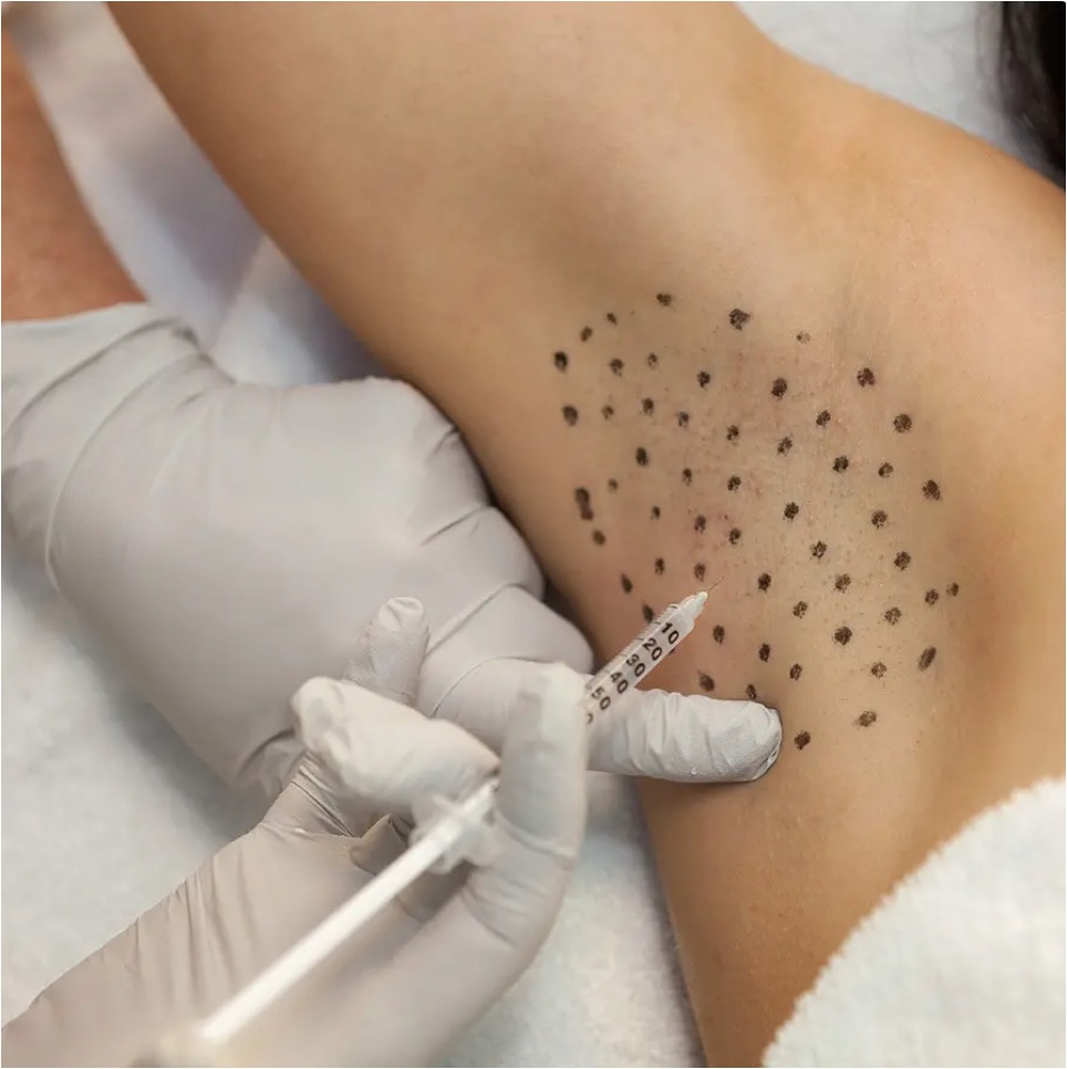 Hyperhidrosis Treatment