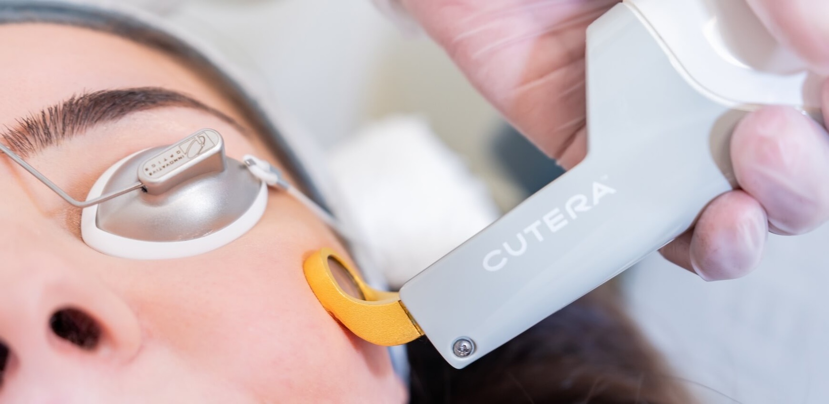 Cutera Excel V Laser